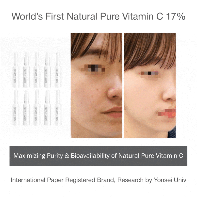 TERACLE VITAMIN C AMPOULE — 10 × 2 mL each